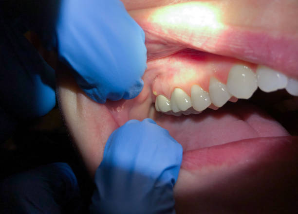 Best Emergency TMJ Treatment in Smith Mills, MA