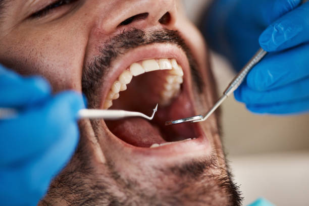 Best Emergency Treatment for Dental Infections or Abscesses in Smith Mills, MA