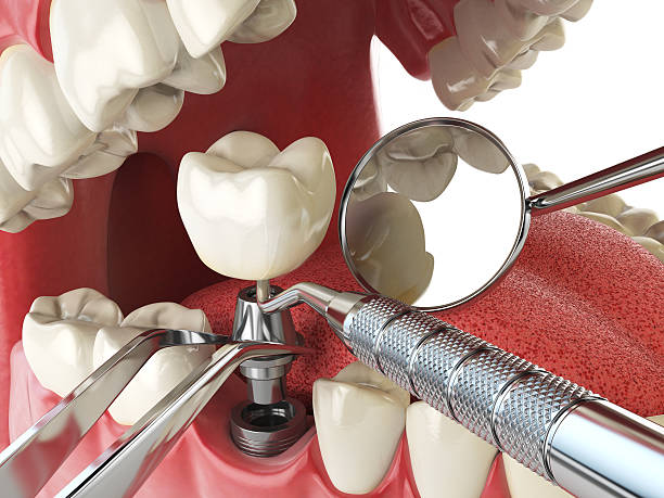 Best Emergency Denture Repair in Smith Mills, MA